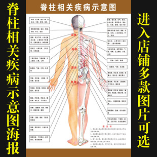 脊柱相关疾病人体经络穴位图挂图中医养生图片宣传画海报661