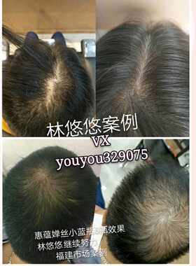 惠蕴婵丝小蓝瓶4年老店小红书推荐私人订制不定价专拍详询客服