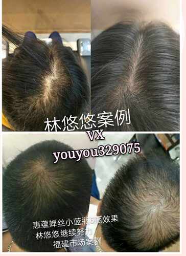 惠蕴婵丝小蓝瓶4年老店小红书推荐私人订制不定价专拍详询客服