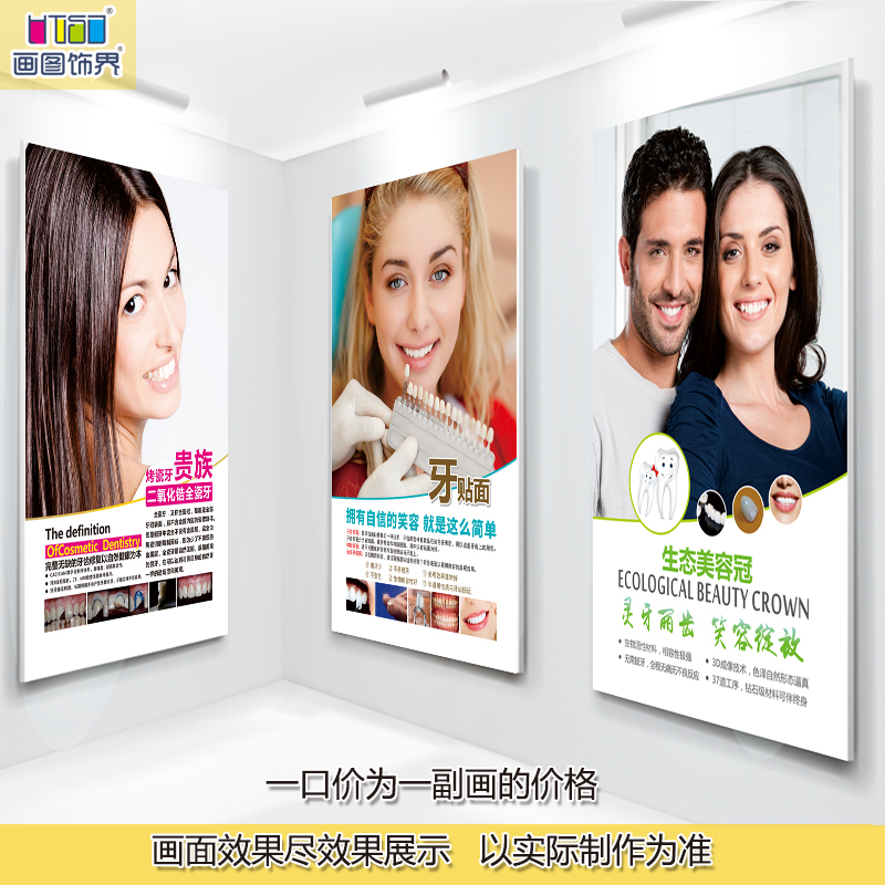 【美容修复】牙科挂图口腔医疗门诊种植牙海报宣传装饰画烤瓷-05|ruв категории Домашний быт, декоративная живопись, без рамы картину настенные часы - от Buy2taobao.com для оказания профессиональной услуги покупки агента Taobao