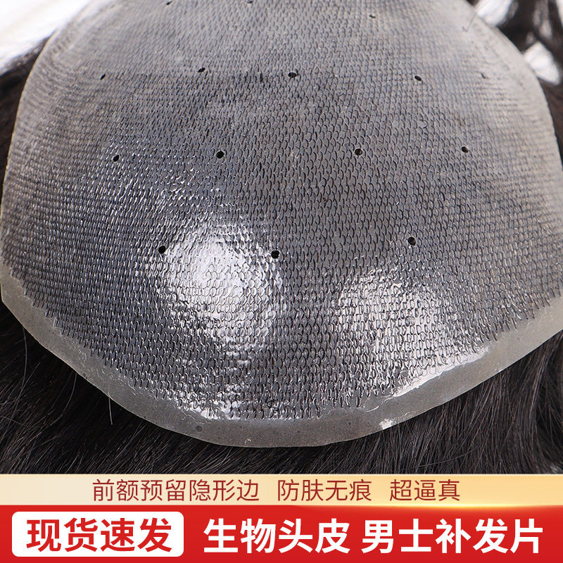 生物头皮假发片男头顶补发块前额地中海发片真发丝毛坯隐形短发
