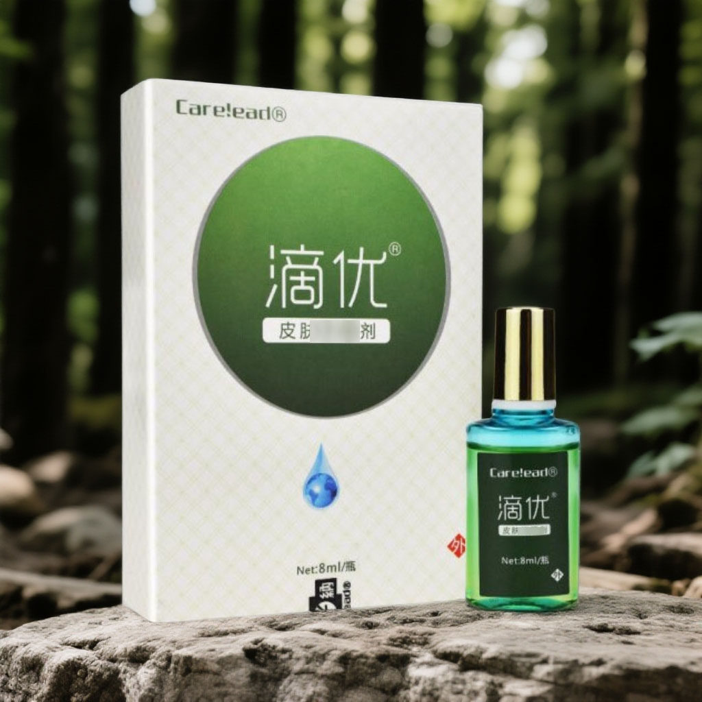 四川康纳滴优液脚底老茧关节茧手茧子去老皮