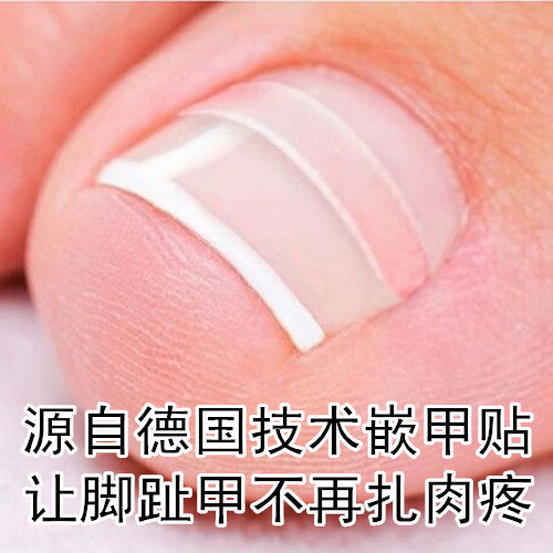 源自德国正品拉拉贴服务正甲贴