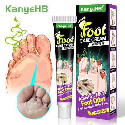 KanyeHB 脚气膏药 脚臭护理膏 足部皮肤外用膏 跨境wish