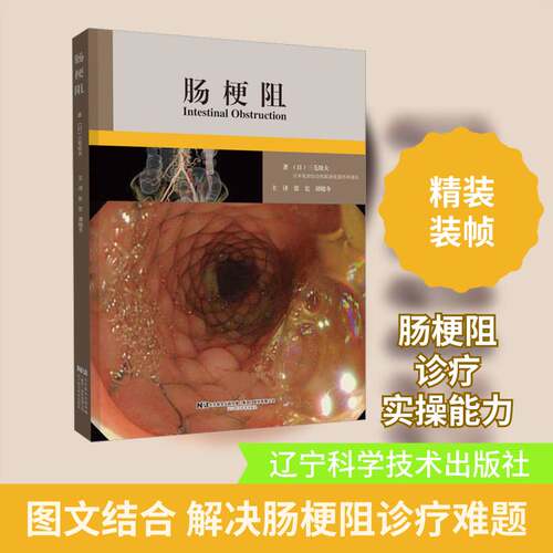 正版肠梗阻9787559125231 三毛牧夫辽宁科学技术出版社医药卫生  书籍