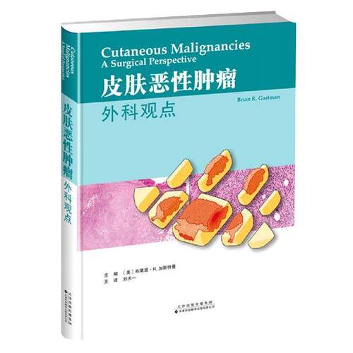 正版皮肤恶性：外科观点：a surgical persped ctive9787543341104 布莱恩·加斯曼天津科技翻译出版医药卫生  书籍