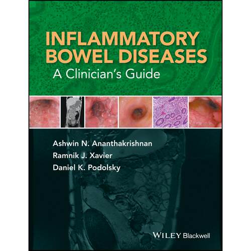 【预售 按需印刷】英文原版炎症性肠病Inflammatory Bowel Diseases原装进口正版书籍