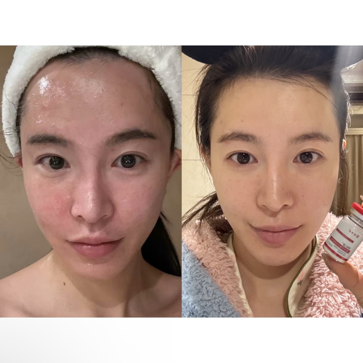 部分反馈合集！ 三型胶原周年庆王炸活动一年仅此一次