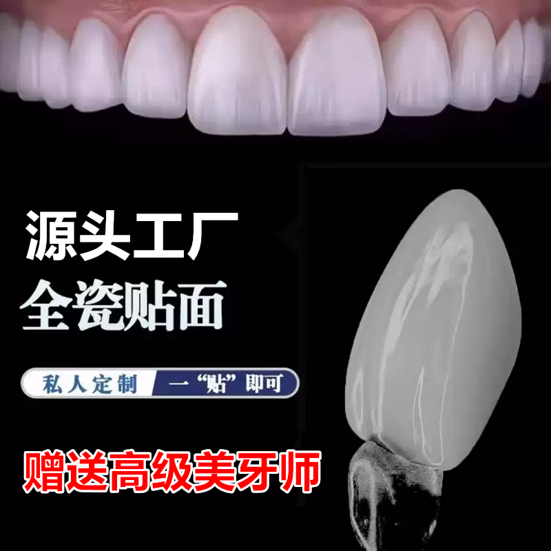 全瓷贴面超薄义获嘉灵犀瓷蓝瓷牙缝黄牙遮色美白瓷贴面牙齿贴片