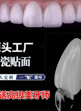 全瓷贴面超薄义获嘉灵犀瓷蓝瓷牙缝黄牙遮色美白瓷贴面牙齿贴片