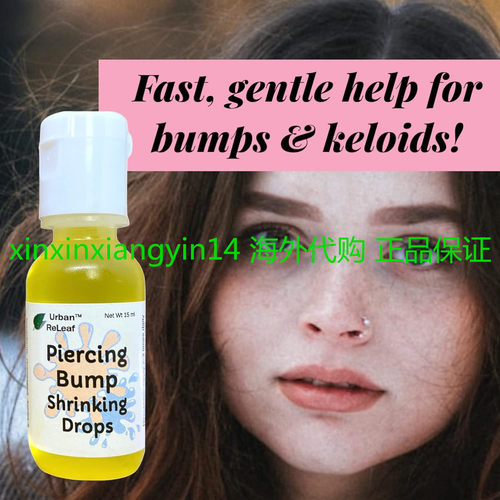 Urban ReLeaf Piercing Bump Shrinking Drops! Keloid Bumps