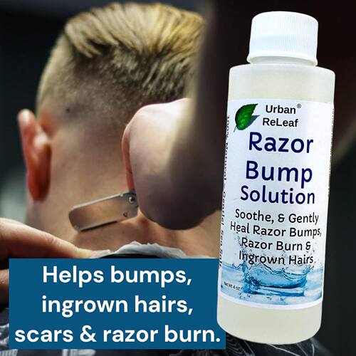 Urban ReLeaf Razor Bump Solution