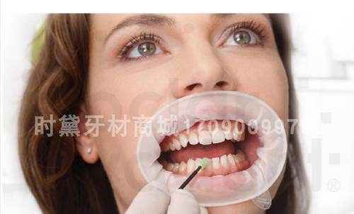 进口义获嘉optragate白色开口器