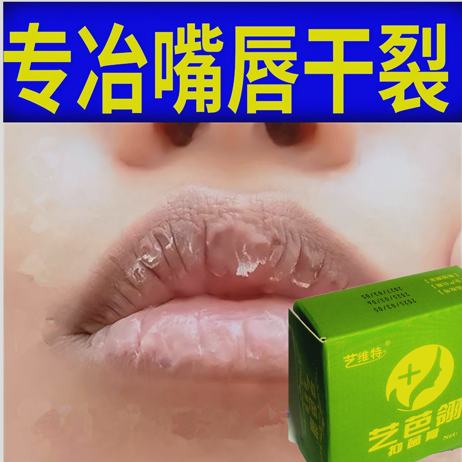 唇干裂脱皮唇纹抑疤灵艺维特唇膏唇膜唇部修复保湿唇炎起皮掉皮