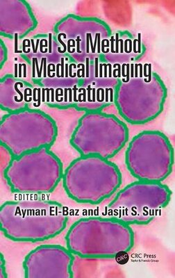 预售 按需印刷 Level Set Method in Medical Imaging Segmentation