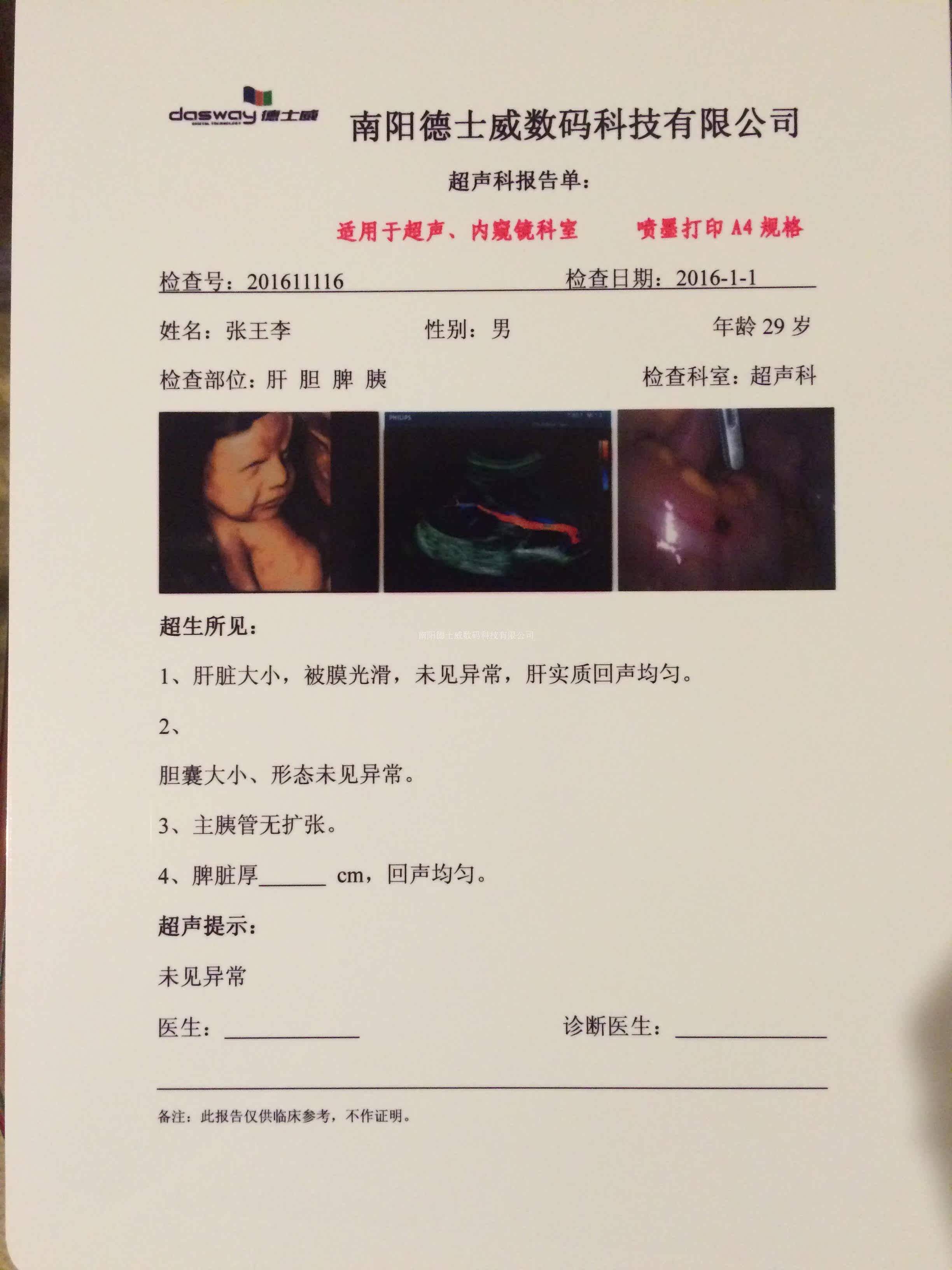 瓷白双面激光数码医疗彩超Ｂ超打相片纸