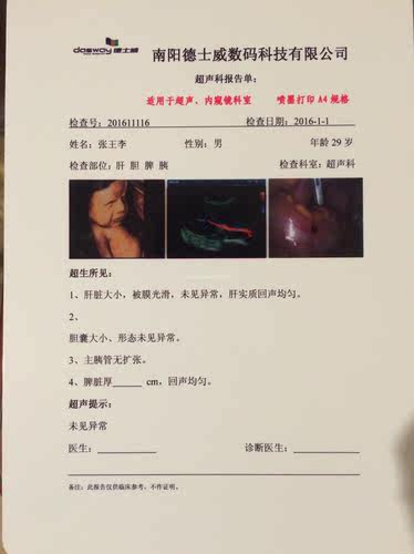 瓷白双面激光数码医疗彩超Ｂ超打印报告蓝基胶片 医用干式胶片