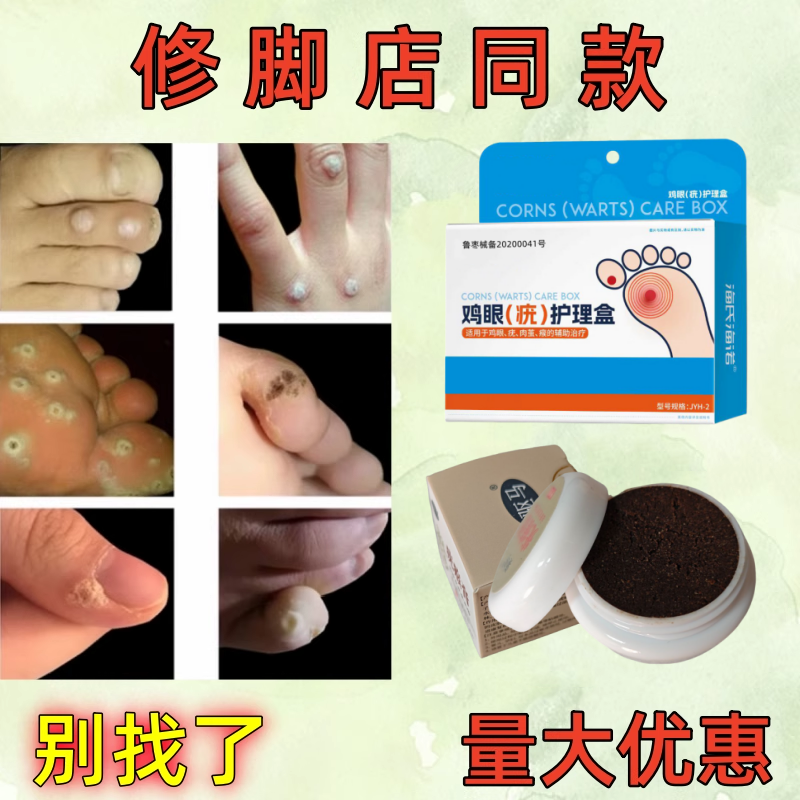 跖疣鸡眼专用膏（修脚店同款）