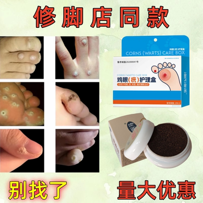 跖疣鸡眼专用膏（修脚店同款）