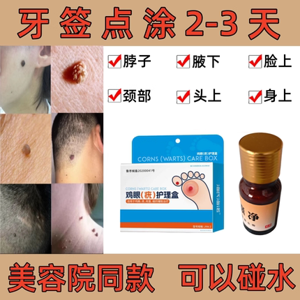 脖子小肉粒跖疣丝状扁平疙瘩身上专用膏贴去除神器一抹无忧灵驱马