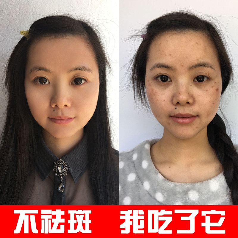 正品美白祛斑霜去斑淡斑产品 淡化色斑黄褐斑雀斑祛 懒人素颜霜