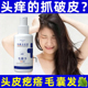臻羞毛囊净喷雾清洁头皮发丝护发养发液去头屑精华毛囊营养液补水