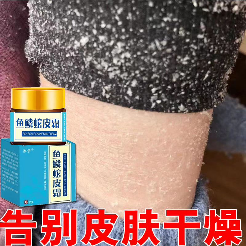 鱼鳞皮肤霜全身去鸡皮疙瘩腿部干燥起皮祛蛇皮腿去除克星