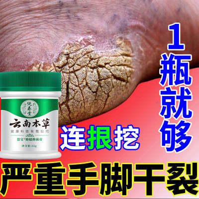 脚后跟干裂修复霜防脚裂手指裂口龟裂干燥起皮足底皴裂蜂蜡抑菌膏