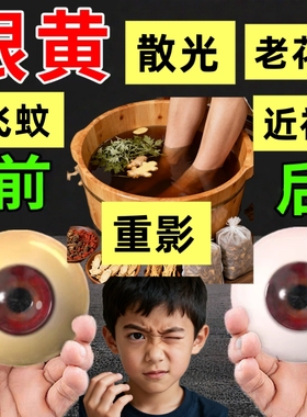 中草目决明子牡丹栀子桑叶泡脚泡眼睛黄散光重影近老花视物澡药包