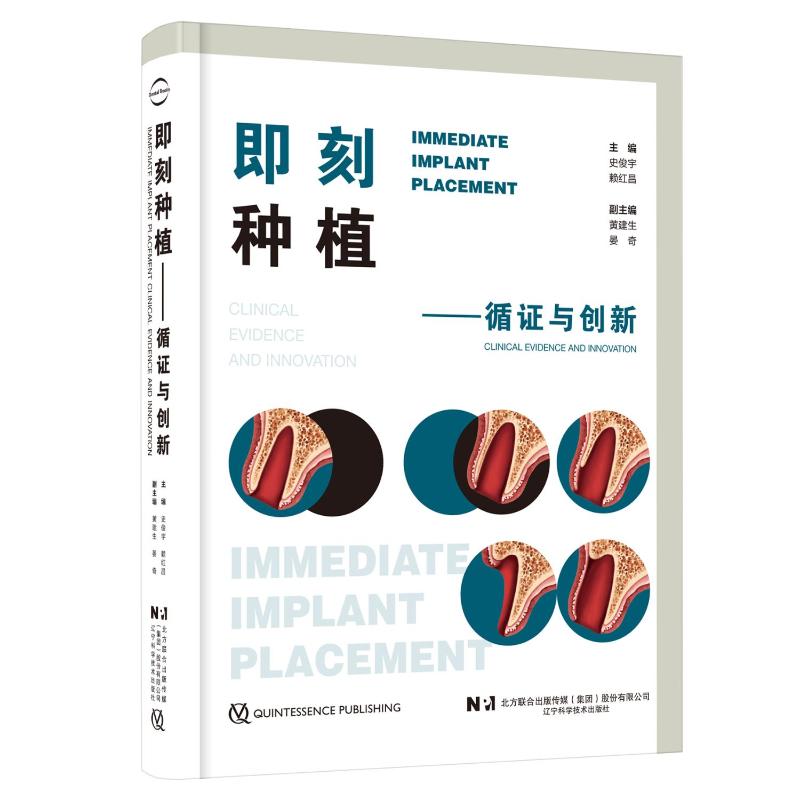正版图书即刻种植——循与创新史俊宇,赖红昌 编辽宁科学技术出版社医学卫生/耳鼻喉科学纸质书籍