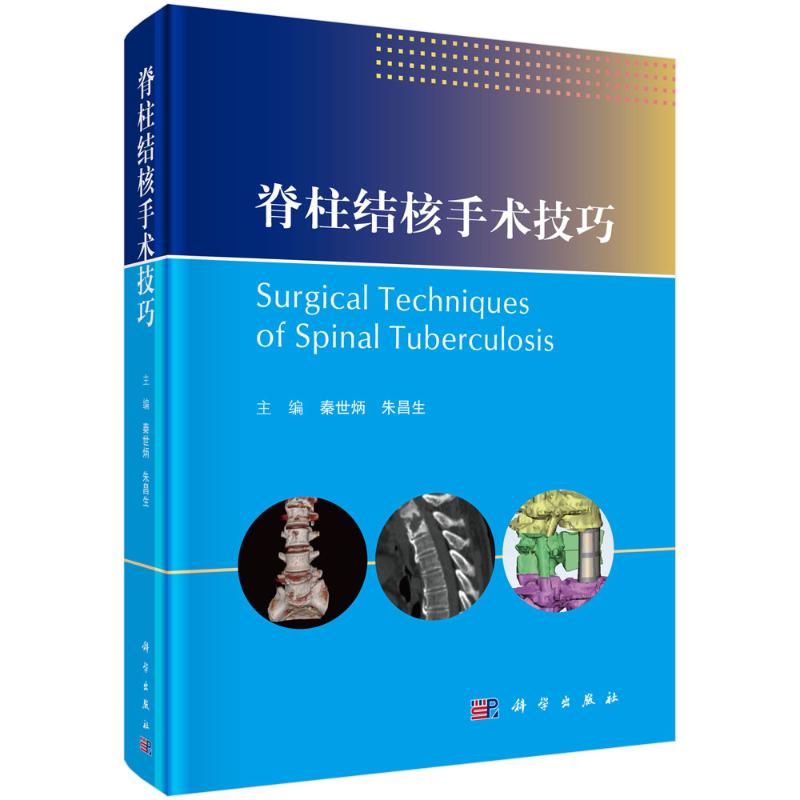正版图书脊柱结核手术技巧秦世炳,朱昌生科学出版社医学卫生/外科学纸质书籍