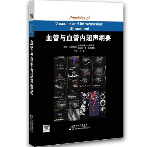 正版图书血管与血管内超声纲要(加) 哈奇森(Hutchison,S.J.) , (加) 福尔摩斯 (Holmes,K.C.)著，何文 等译天津科技翻译出版公司