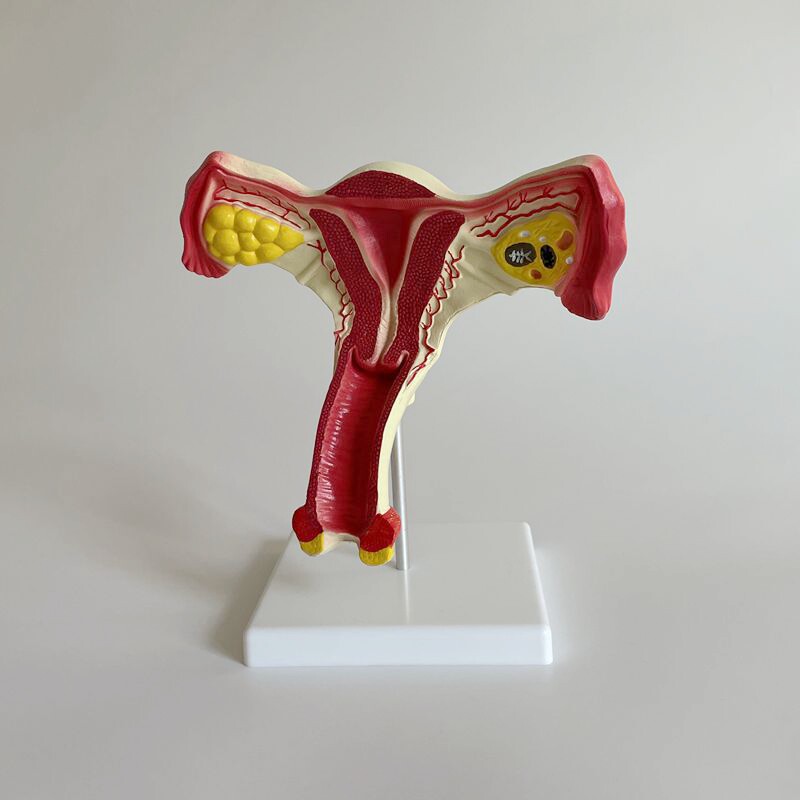 康泰模型女性子宫解剖妇科医生教学生殖医药促销卵巢结构病理医患