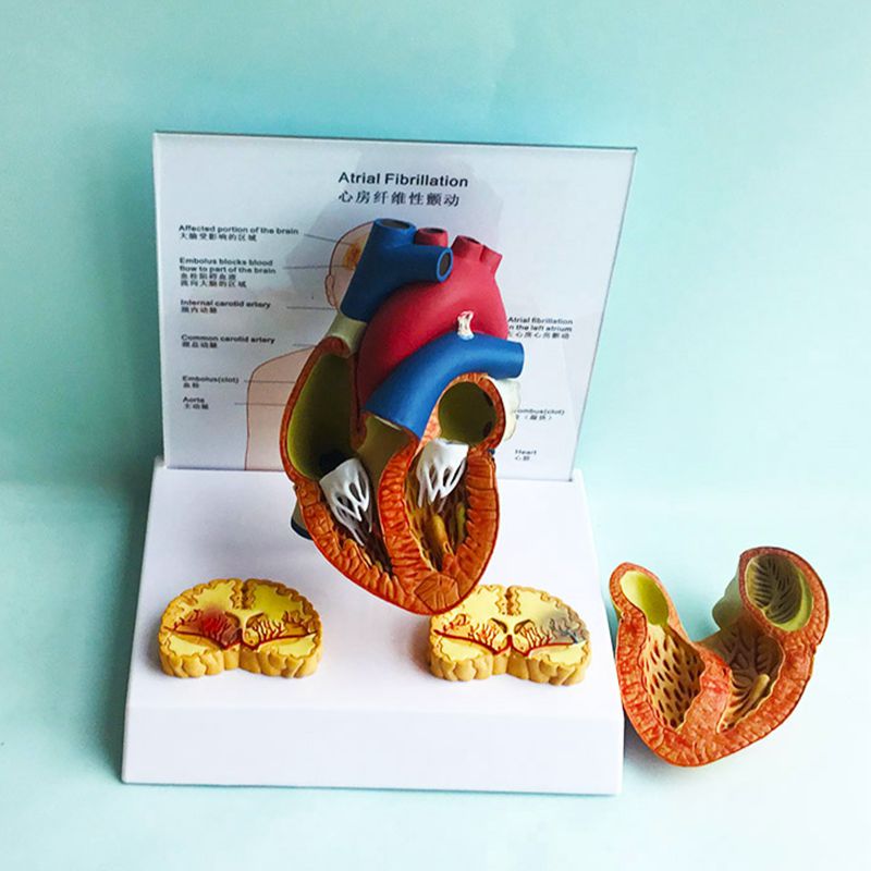 病理心脏模型瓣膜内科临床医学