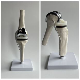 膝关节模型模拟置换术半月板韧带软骨临床骨科医生手术医患沟通用