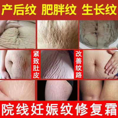 去妊娠纹淡化紧致肚皮修复霜