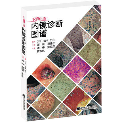 下消化道 内镜诊断图谱 松本主之 消化内科 药物所致的出血性大肠炎 免疫检查点抑制剂相关肠炎 淀粉样变性 内科医学书籍