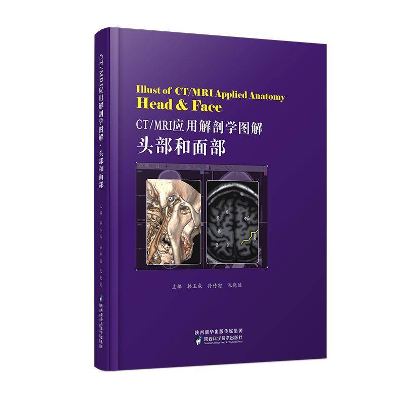 RT正版 CT/MRI应用解剖学图解:头部和面部:Head & face9787536977693 韩玉成陕西科学技术出版社医药卫生书籍
