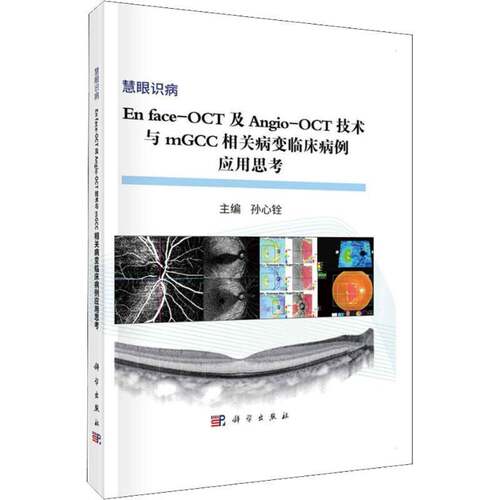 RT现货速发 En face-OCT及Angio-OCT技术与mGCC相关病变临床病例应用思考9787030583192 孙心铨科学出版社医药卫生书籍