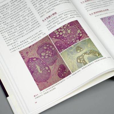 RT正版 乳腺癌精要:外科观点:perspectives for surgeons9787523212578 世界图书出版西安医药卫生书籍