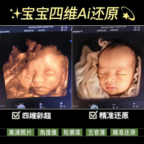 宝宝四维彩超ai照片还原高清修复