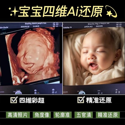 宝宝四维还原ai彩超照片深度高清