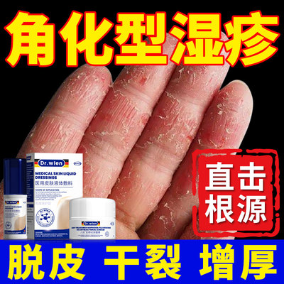 德国DR.WLEN手部角化型湿疹手癣膏脱皮干裂真菌感染止痒专用手脚