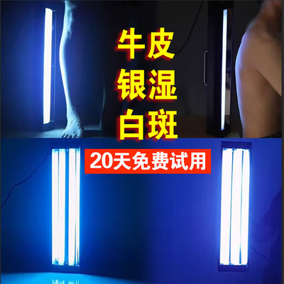 窄谱中波紫外线UVB311nm白斑白癜牛皮银湿屑308nm波长准分子希格
