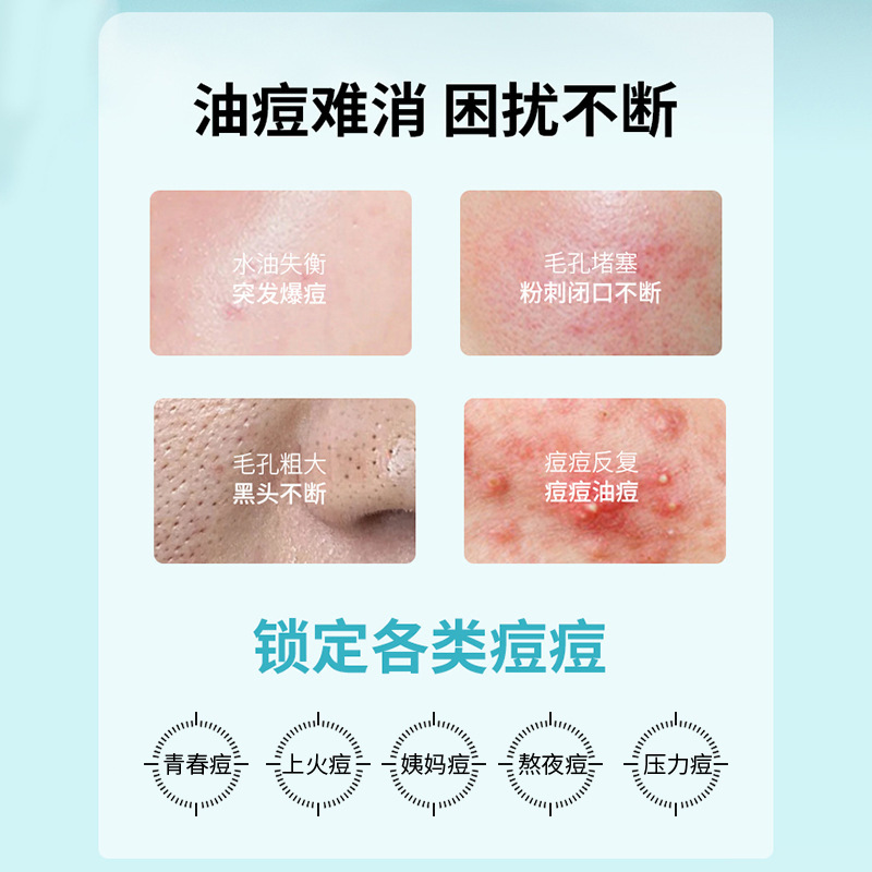 iOEO壬二酸祛痘凝胶20% 祛痘膏黑头痘印粉刺祛痘霜