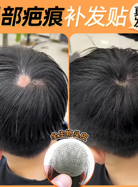 疤痕补发贴片男士假发片