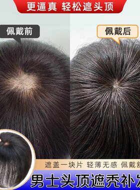 假发片男士仿真人发头旋发缝男补发遮盖伤疤头顶部增发脱发补发片