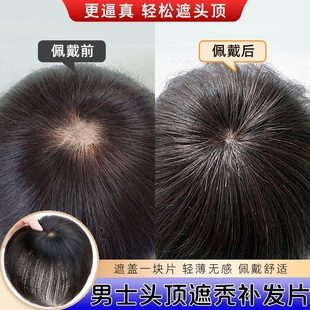 假发片男士仿真人发头旋发缝男补发遮盖伤疤头顶部增发脱发补发片
