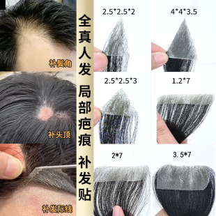 胎毛刘海补发片发饰男女发际线前额两鬓秃少发自然隐形轻薄真贴片