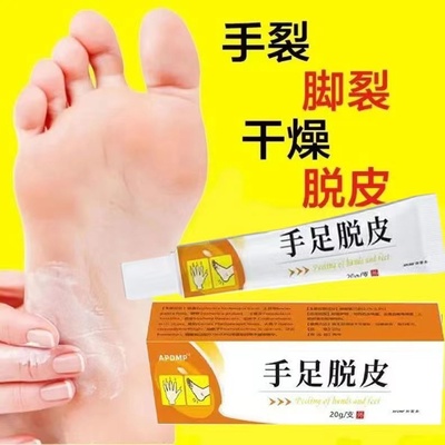 手足脱皮膏护肤膏手指上起皮干燥脱皮脚底防手干裂抑菌膏皮肤真菌